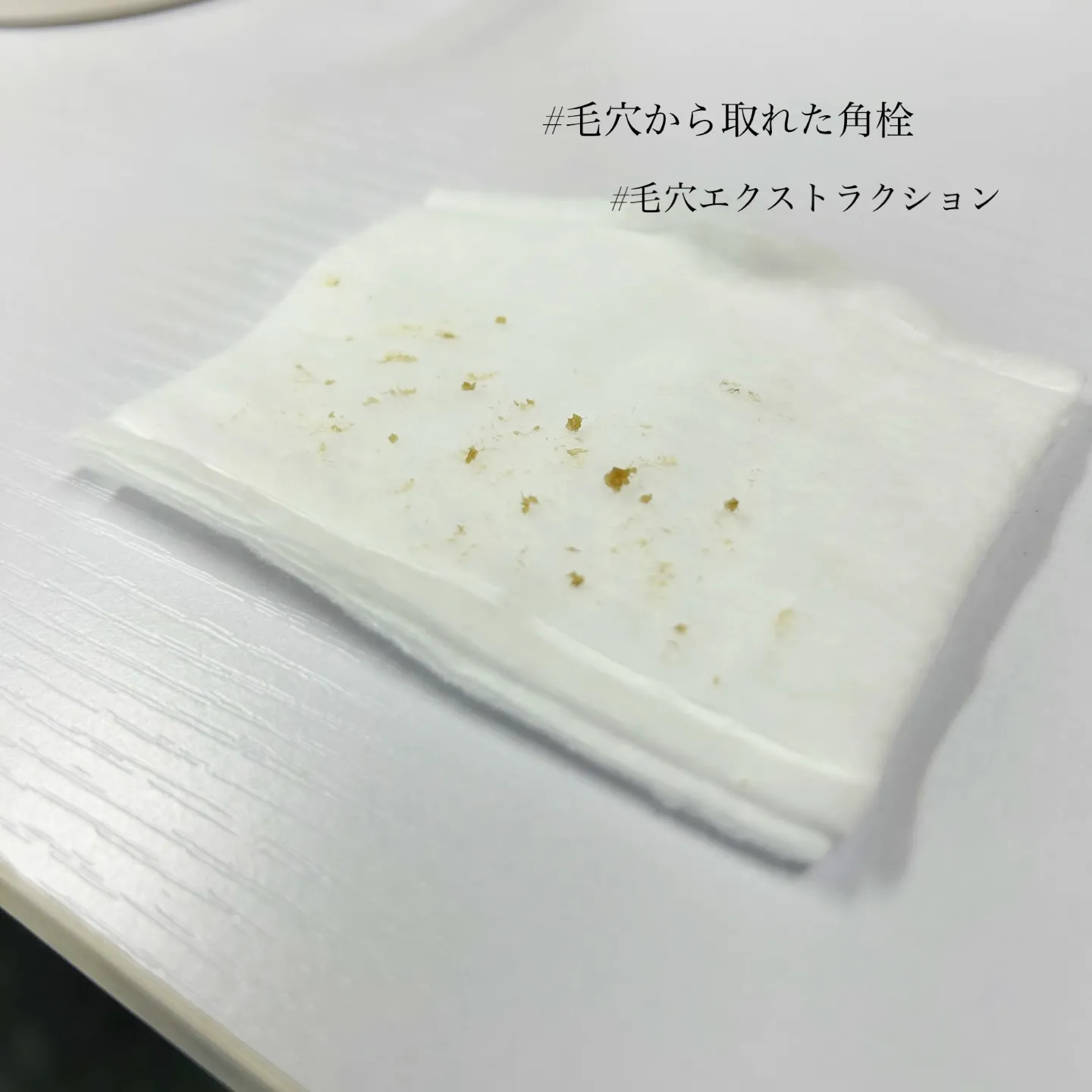 【毛穴エクストラクション施術📷 Before/after 】