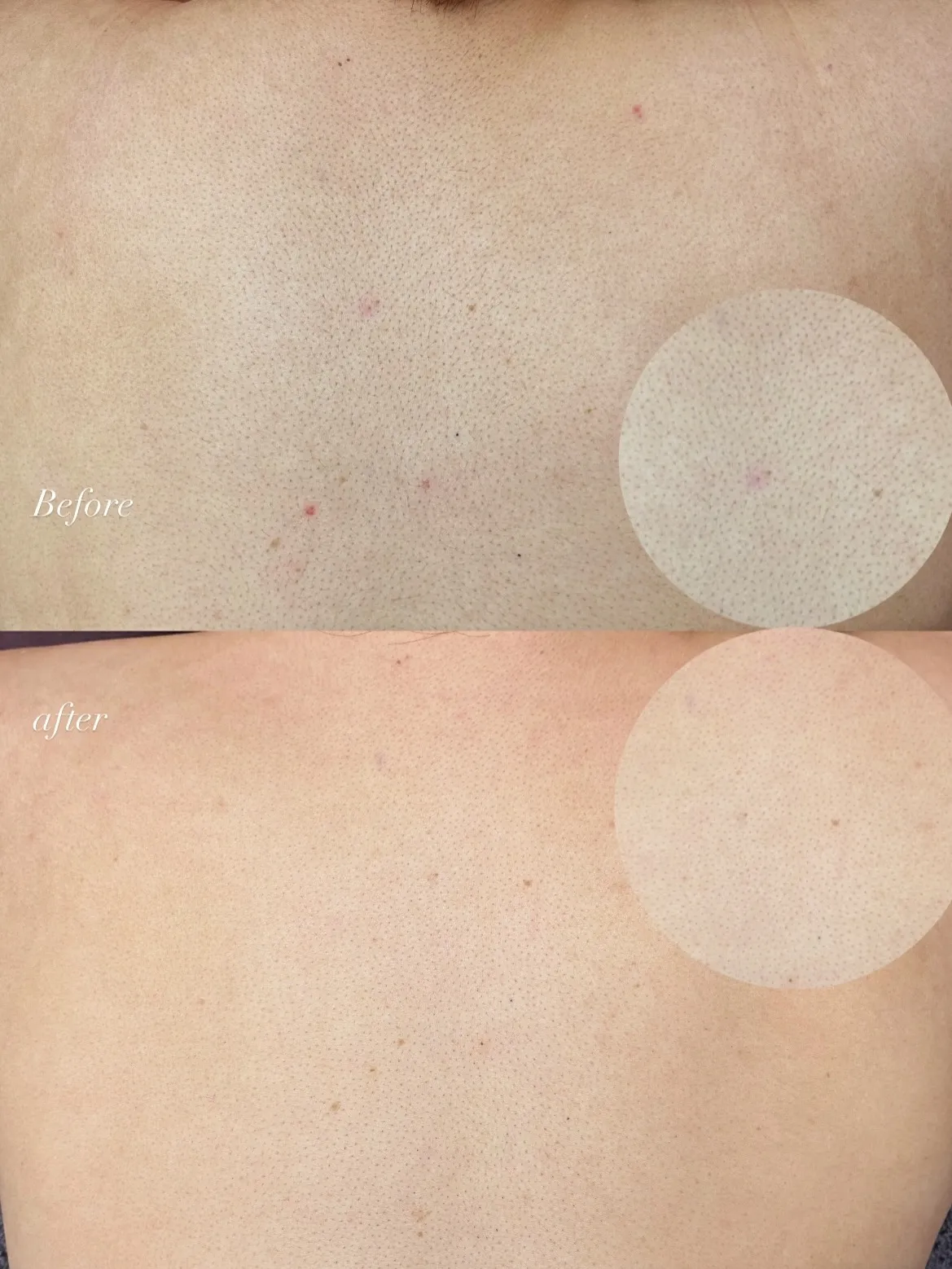 【明石・舞子からのアクセス◎都度払い脱毛★】