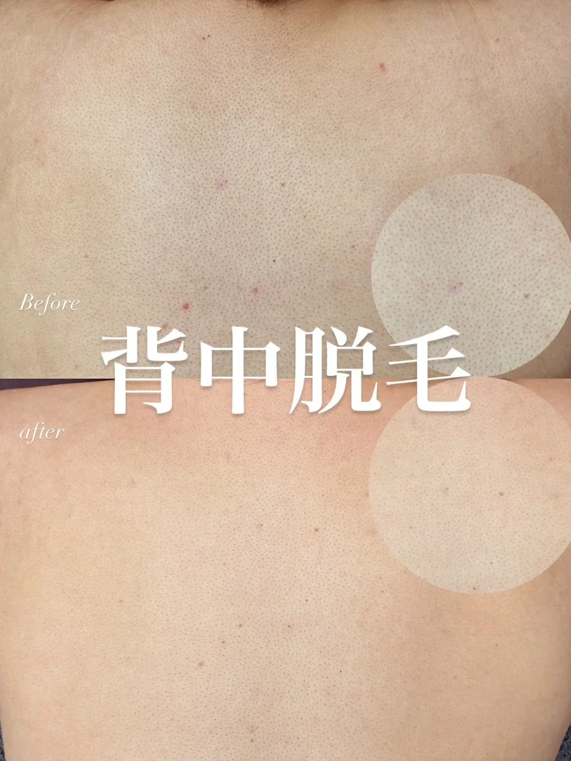 【明石・舞子からのアクセス◎都度払い脱毛★】