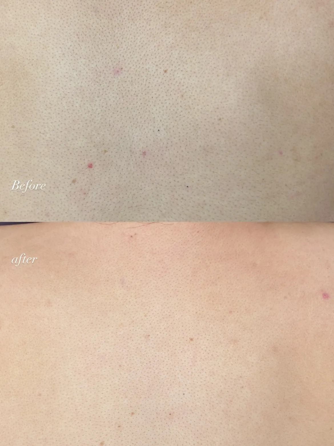 【明石・舞子からのアクセス◎都度払い脱毛★】