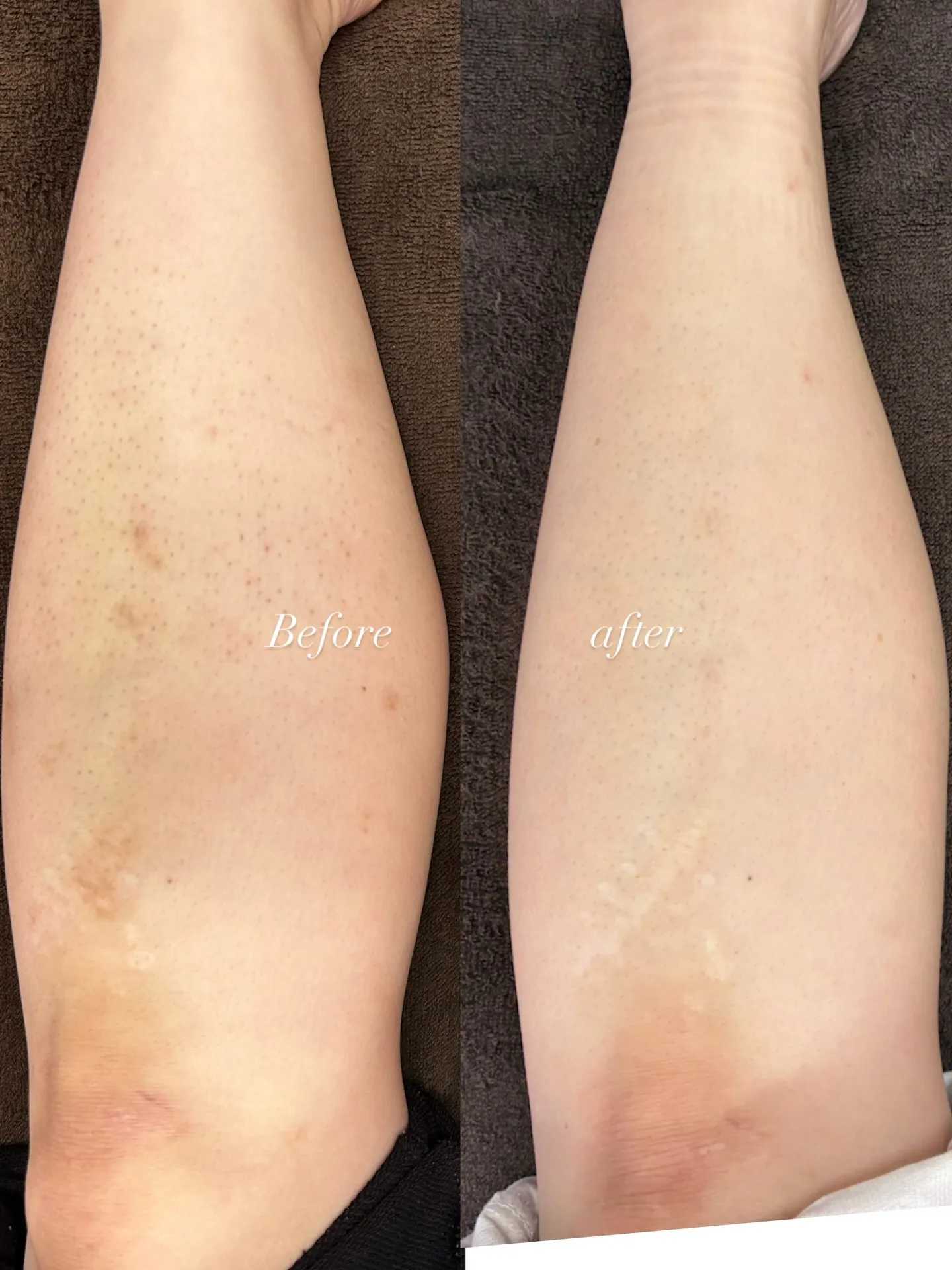 【朝霧 舞子エリアすぐ★脱毛サロン】