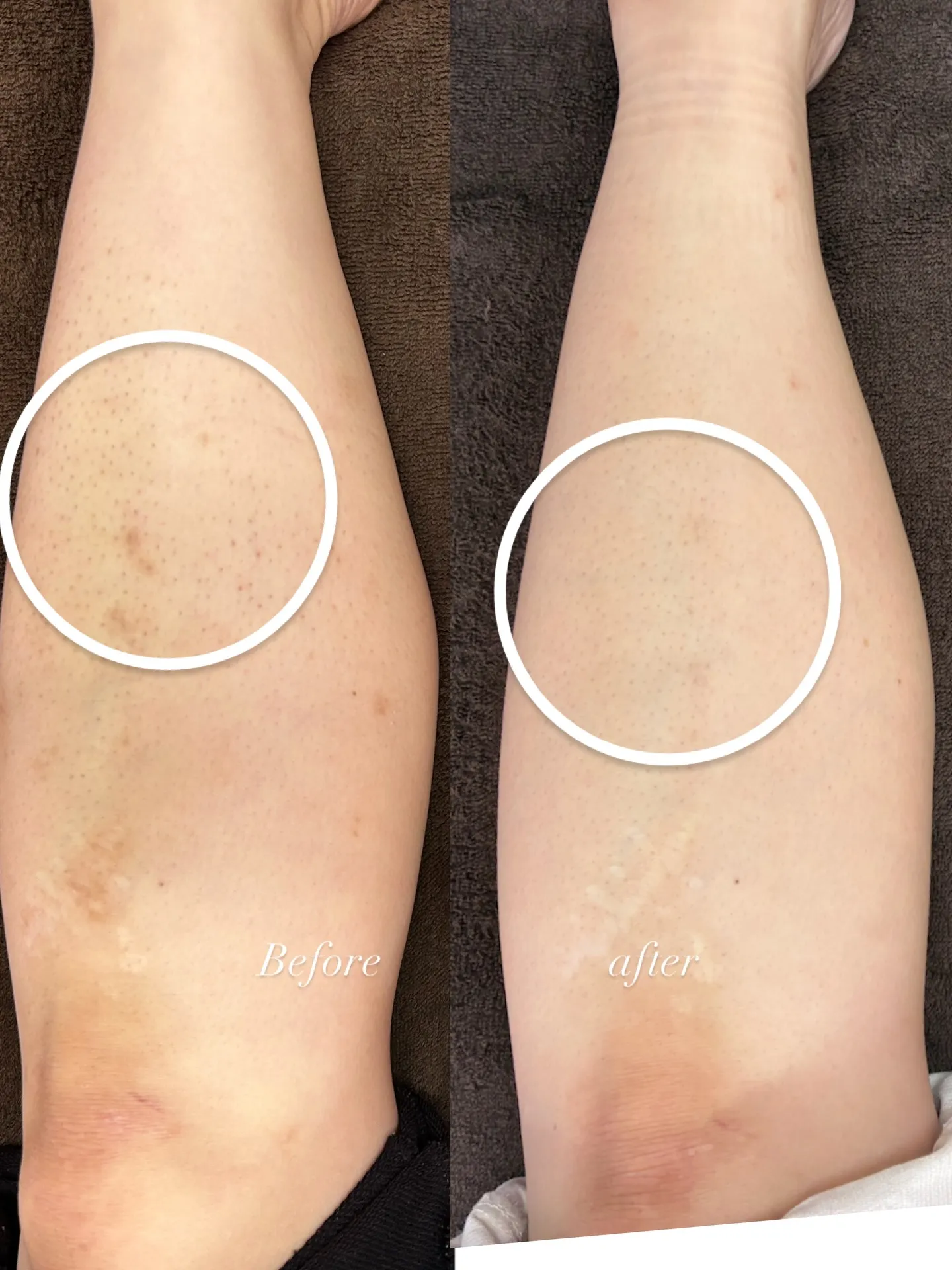 【朝霧 舞子エリアすぐ★脱毛サロン】